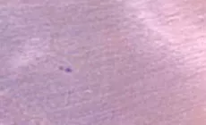 Eliminación de manchas brillantes