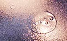 Inspección de los daños