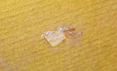 Coincidencia de color