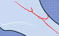 Diagrama de mástil agrietado